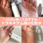 40代後半×トラネキサム酸 化粧水！シミを美白も【おすすめ5選】50代にも
