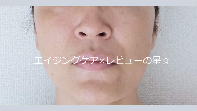 【カバー前】ファンデーション ▲【変身前】SHISEIDO シンクロスキンセルフリフレッシングファンデーション