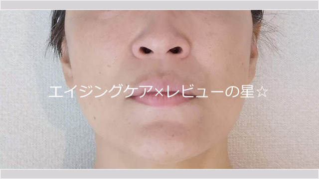 【カバー中】ファンデーション ▲【変身後】SHISEIDO シンクロスキンセルフリフレッシングファンデーション