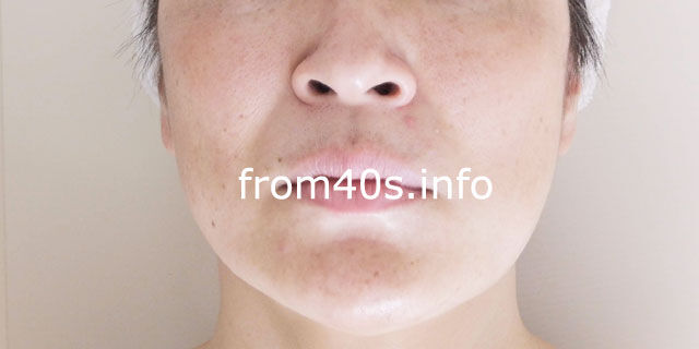 ▲【メイク前】スック(SUQQU) スック(SUQQU)諭吉ファンデーション+下地のメイク効果は?