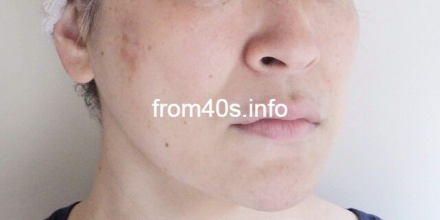 ▲【メイク前】エトヴォス(ETVOS)ミネラルファンデーション