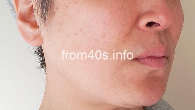 【メイク前】ルミナス フィット クッションファンデーション